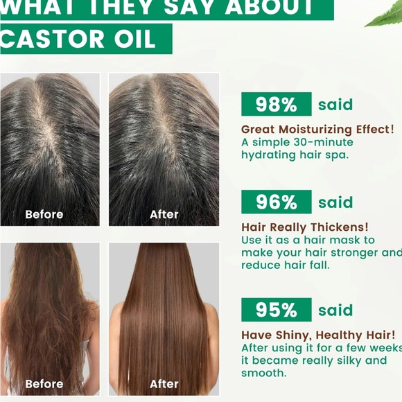 Phatoil Castor Oil with Applicators - Picture 7 of 11